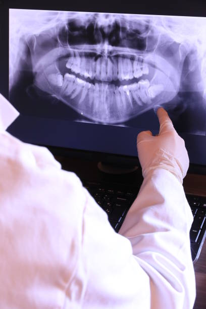 Best Emergency Treatment for Dental Infections or Abscesses in Shongopovi, AZ